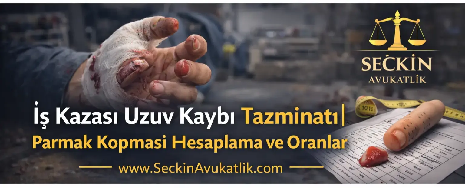 İş Kazası Uzuv Kaybı Tazminatı Parmak Kopması Hesaplama ve Oranlar